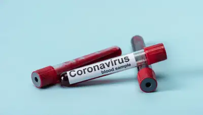 Depositphotos, фото - Новости Zakon.kz от 11.04.2020 01:41