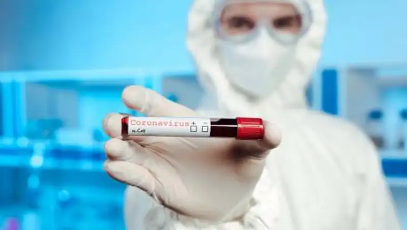 За сутки в Казахстане выявили 52 зараженных коронавирусом