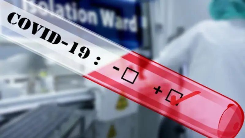 За сутки коронавирусом заболели 53 человека в России