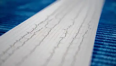 Кардиолог перечислил признаки гипертонического криза , фото - Новости Zakon.kz от 27.08.2022 23:56