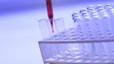 pxhere.com, фото - Новости Zakon.kz от 25.03.2020 12:12