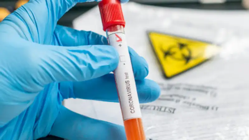 Число заболевших коронавирусом в Казахстане возросло до 4 422