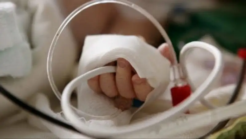 В крайне тяжелом состоянии находится девочка, впавшая в кому после стоматологии