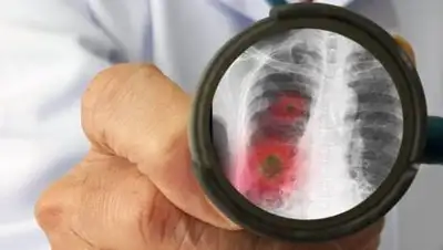 Shutterstoc, фото - Новости Zakon.kz от 23.10.2020 09:03