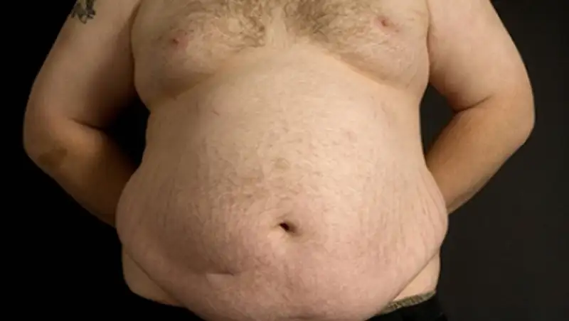 Найден главный виновник ожирения и диабета