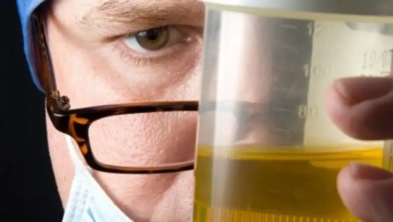 В Кыргызстане родители лечили онкобольную дочь мочой верблюда