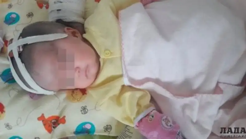 Врачи Мангистау спасли жизнь новорожденному ребенку