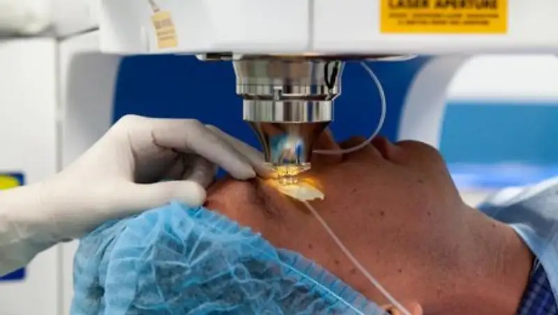 Что нужно знать о глазных операциях по методу LASIK