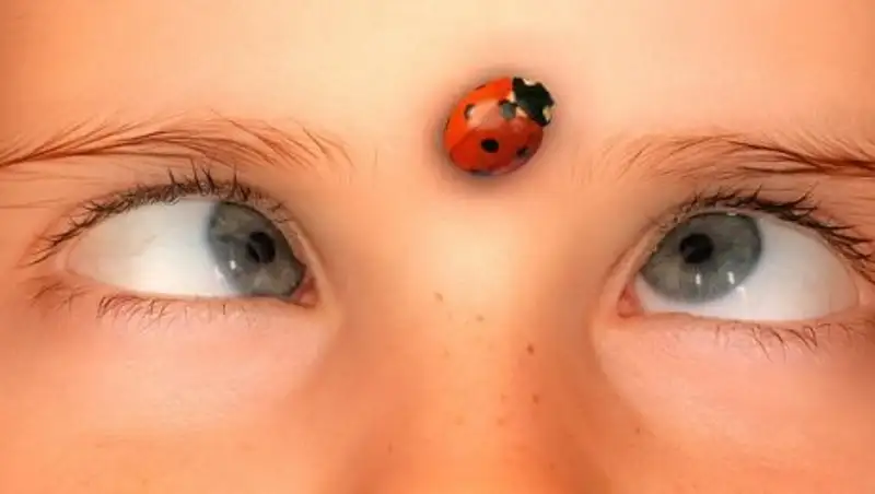 Косоглазие: причины, диагностика и исправление