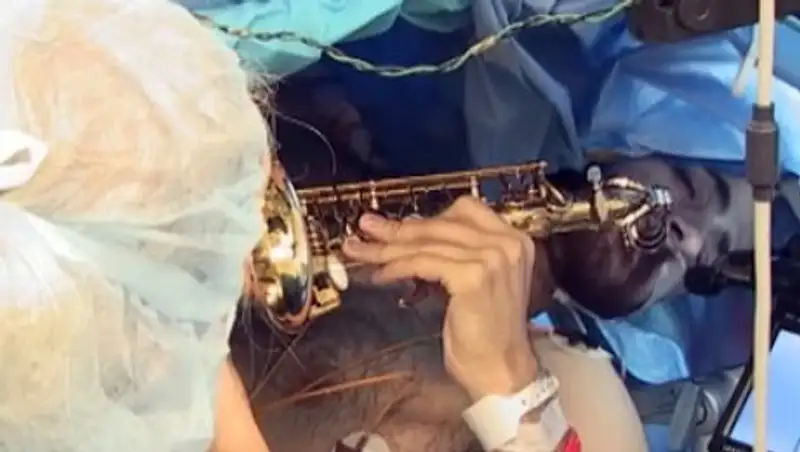 У музыканта удалили опухоль мозга во время игры на саксофоне