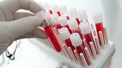 Zakon.kz, фото - Новости Zakon.kz от 28.07.2017 20:05