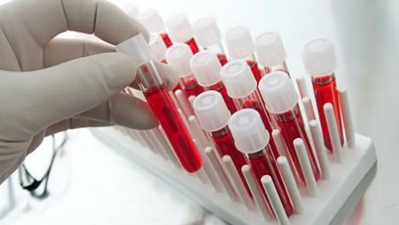 Анализ крови поможет обнаружить сразу 13 форм рака