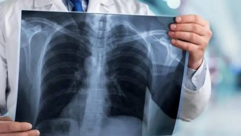 Число заболевших пневмонией казахстанцев продолжает расти