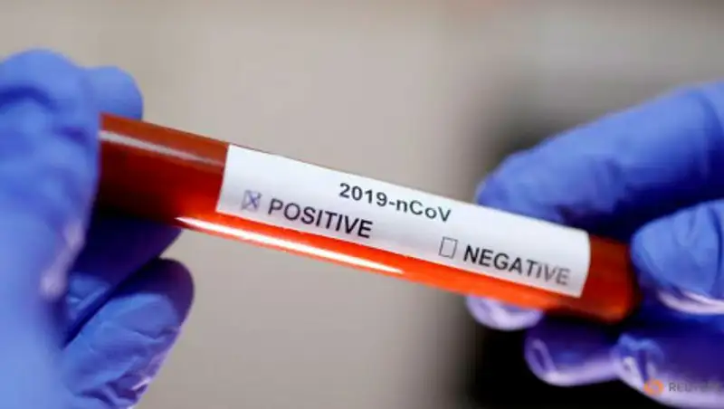 Диагноз коронавирусной инфекции подтвержден у 1852 казахстанцев