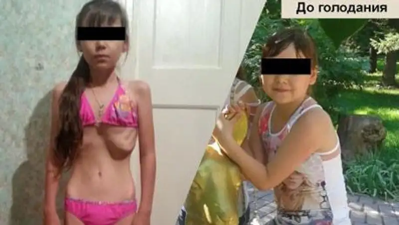 Замечание учителя могло стать толчком к развитию анорексии у девятилетней девочки из ВКО