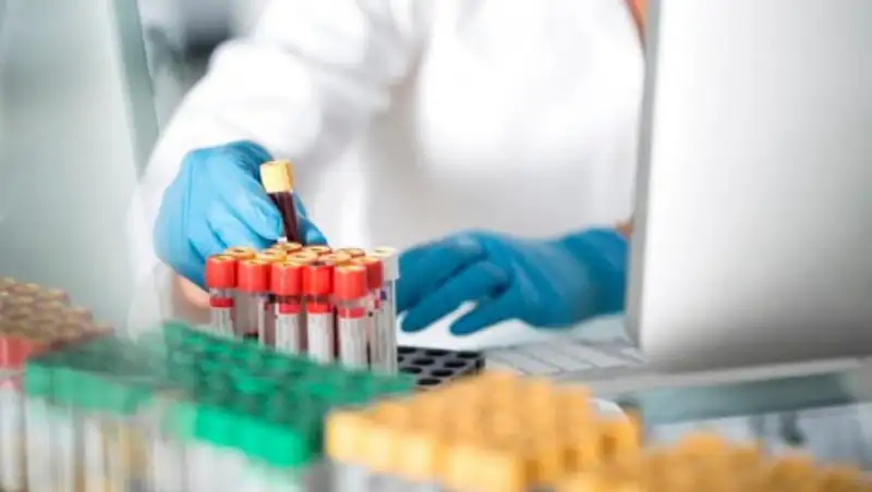 За сутки в Казахстане выявили 104 случая заражения Covid-19