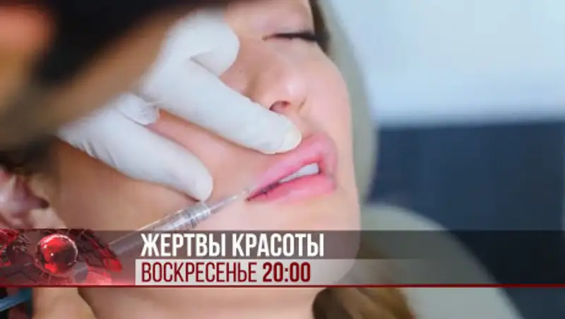 Жертвы косметологии. Приходили за красотой, а ушли с проблемами