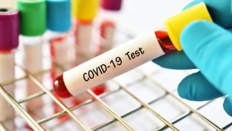 67 заболевших КВИ выявлено в Казахстане за сутки