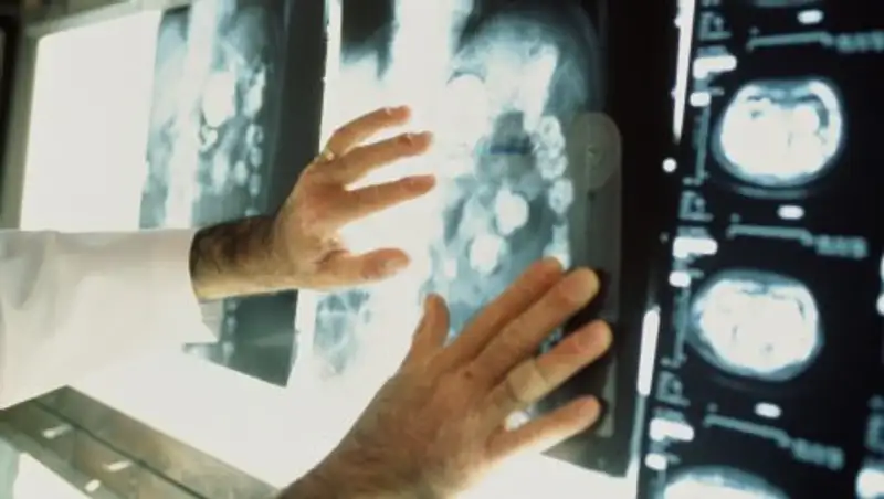 В Минздраве рассказали о развитии специализированных стационаров в составе многопрофильных больниц