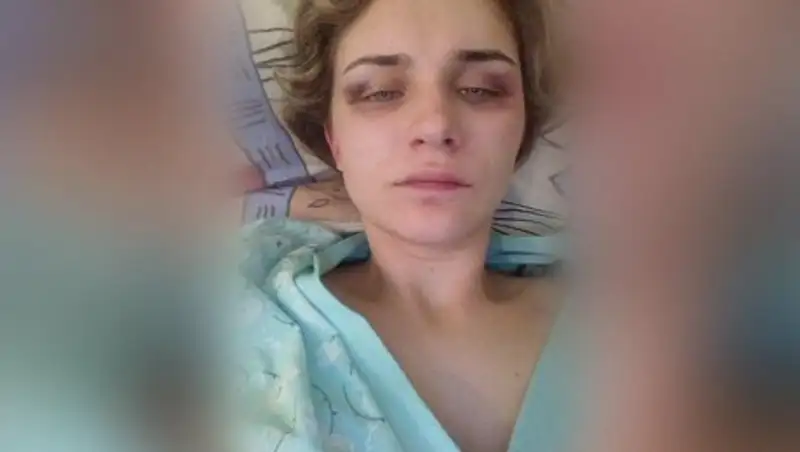 Россиянин избил бывшую жену и пытался снять с неё скальп