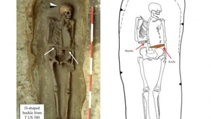 В Италии нашли скелет с протезом-ножом вместо руки