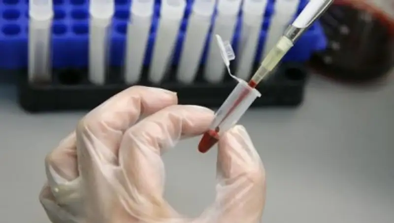 В Минздраве рассказали о гепатите А среди школьников ВКО