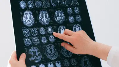 усталость, невролог, врач, фото - Новости Zakon.kz от 16.08.2022 15:22