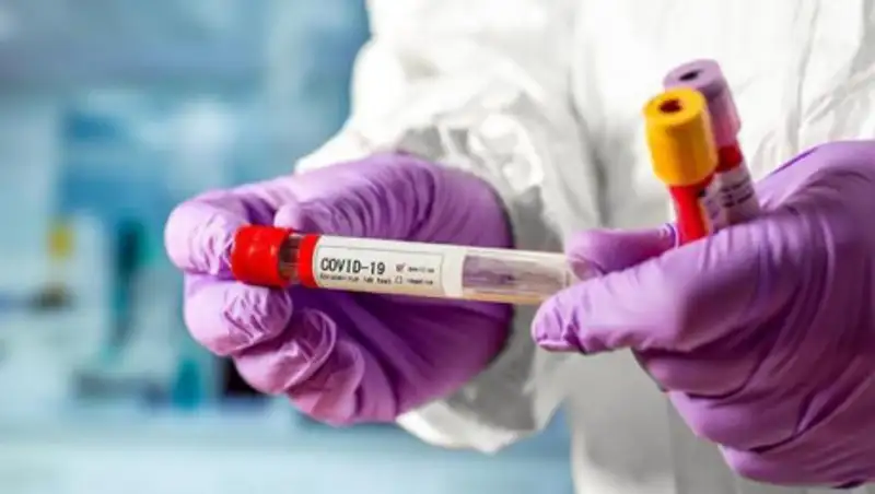 До конца мая мощность тестирования на КВИ увеличат до 25 тысяч в сутки