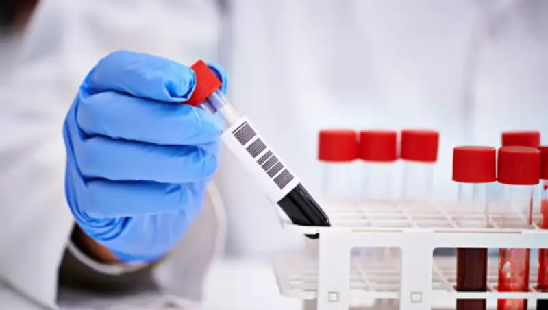 Еще 4 казахстанца выздоровели от коронавируса