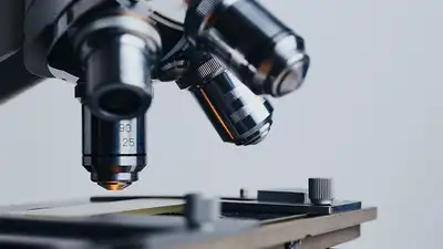 сибирская язва, фото - Новости Zakon.kz от 10.06.2023 00:30