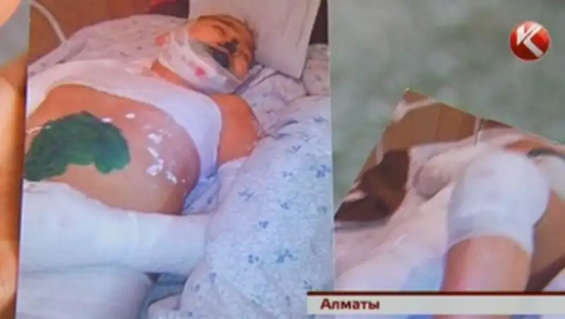 ЧП в алматинском интернате: больной ребенок получил тяжелые травмы