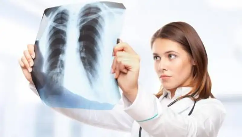 Еще 263 казахстанца заболели пневмонией