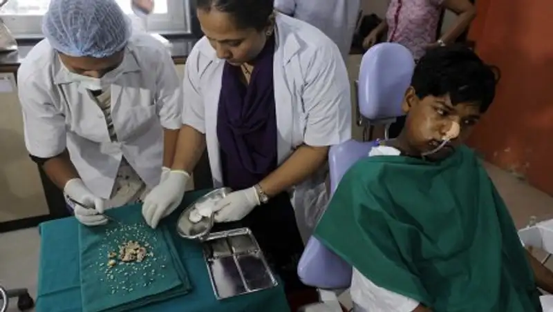 Индийскому подростку удалили самый длинный в мире зуб