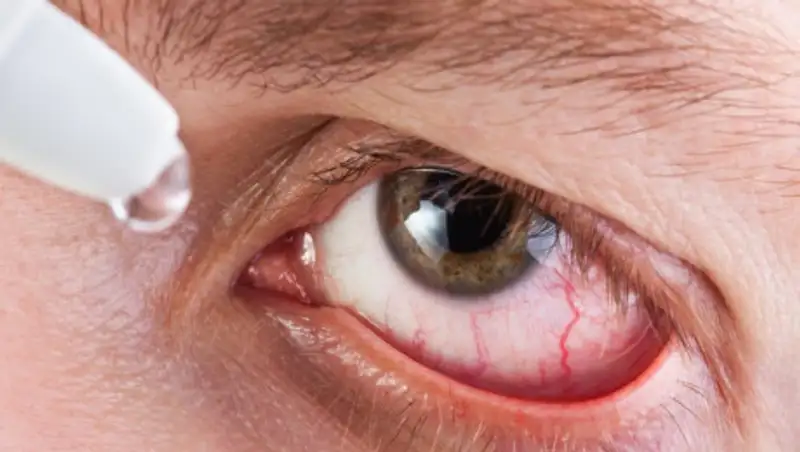 Плюсы и минусы использования глазных капель