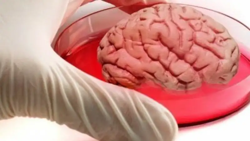 Ученые Великобритании вырастили искусственый мозг из клеток кожи