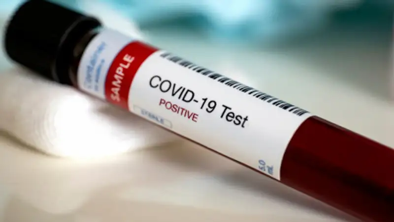 Число случаев заражения коронавирусом в Казахстане достигло 9 576