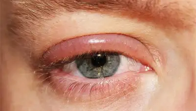 fdoctor.ru, фото - Новости Zakon.kz от 03.05.2019 14:10