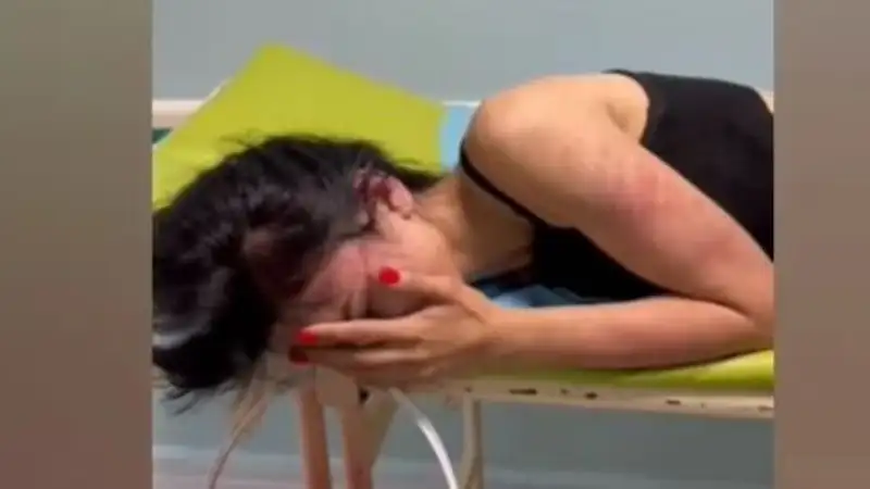 В Алматы женщина попала в больницу со страшными следами побоев супруга