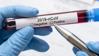 1obl.ru, фото - Новости Zakon.kz от 30.03.2020 09:30