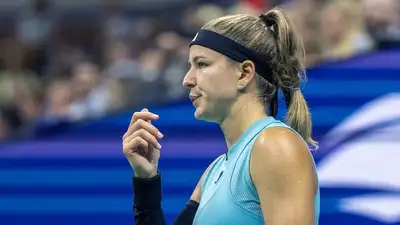 Каролина Мухова рассказала, что перенесла операцию на запястье. , фото - Новости Zakon.kz от 21.02.2024 12:51