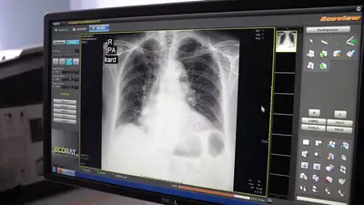 Как будут выдавать электронные личные медкнижки с 2025 года, фото - Новости Zakon.kz от 19.03.2024 12:01