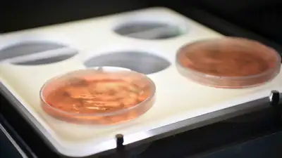 Инфекции, паводки, Казахстан, фото - Новости Zakon.kz от 08.04.2024 16:26