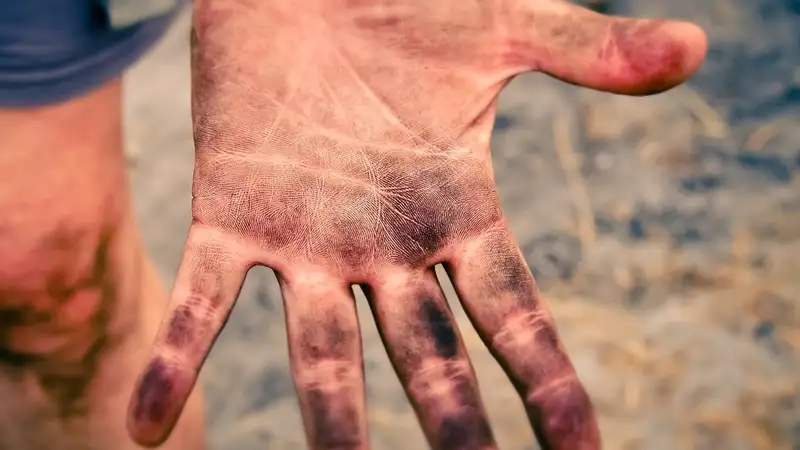 Мужчина попросил доктора отрезать ему два пальца