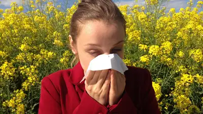 аллергия, сезонная аллергия, , фото - Новости Zakon.kz от 13.05.2024 07:41