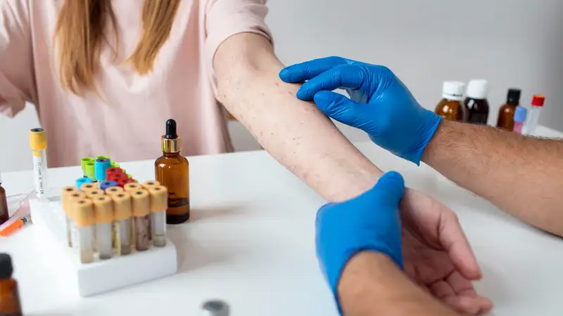 В чем коварство кори для детей, рассказала эксперт