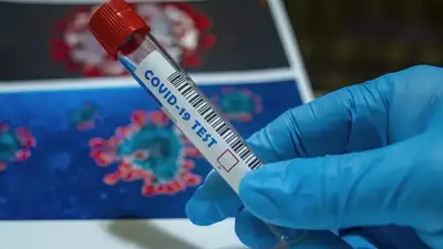 Пандемия COVID-19 сократила продолжительность жизни в мире почти на два года, фото - Новости Zakon.kz от 26.05.2024 06:19