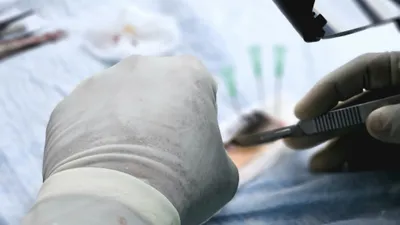 Казахстанец продавал почку через соцсети, фото - Новости Zakon.kz от 21.01.2025 13:32