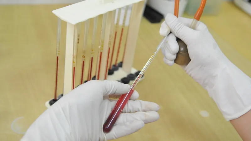 Денсаулық сақтау министрлігі Жоғары және орташа қауіпті медициналық ұйымдардың тізімін толықтырды