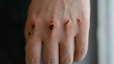 Кулаки, драка, насилие, нападение, потасовка, избиение, перепалка, схватка, разборка, разборки, рукоприкладство, побои, конфликт, бой, борьба, фото - Новости Zakon.kz от 19.10.2025 02:59