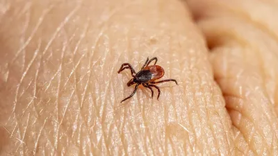 укусы клещей, фото - Новости Zakon.kz от 30.05.2025 13:00